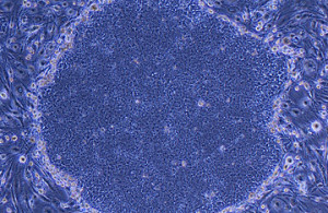 Yamanaka stem cells
